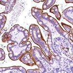 ANKRD32 Polyclonal Antibody