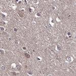 TMC5 Antibody in Immunohistochemistry (IHC)