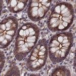 TMC5 Antibody in Immunohistochemistry (IHC)