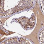 SEC31B Polyclonal Antibody