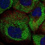 ARHGAP11A Polyclonal Antibody