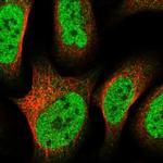 ZNF609 Polyclonal Antibody