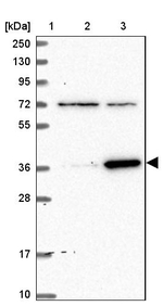 ZNF609 Antibody in Western Blot (WB)