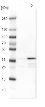 ZNF609 Antibody in Western Blot (WB)
