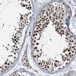 ZNF609 Antibody in Immunohistochemistry (IHC)