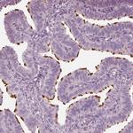 FAM154B Antibody in Immunohistochemistry (IHC)