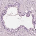 FAM154B Antibody in Immunohistochemistry (IHC)