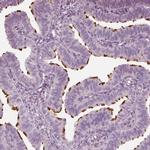 FAM154B Polyclonal Antibody