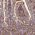PPP2R3C Polyclonal Antibody