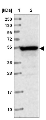 PPP2R3C Antibody in Western Blot (WB)