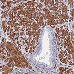 STRA6 Antibody in Immunohistochemistry (IHC)