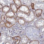 STRA6 Antibody in Immunohistochemistry (IHC)