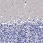 STRA6 Antibody in Immunohistochemistry (IHC)