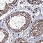 IQCH Antibody in Immunohistochemistry (Paraffin) (IHC (P))