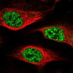 ZC3H18 Polyclonal Antibody