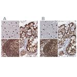 ZC3H18 Antibody in Immunohistochemistry (IHC)
