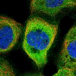 NARFL Polyclonal Antibody