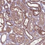 NARFL Antibody in Immunohistochemistry (Paraffin) (IHC (P))