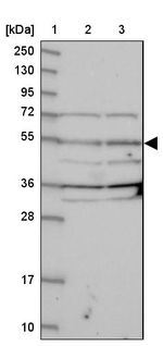 NARFL Antibody in Western Blot (WB)