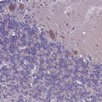 XKR7 Antibody in Immunohistochemistry (Paraffin) (IHC (P))