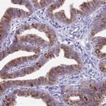 XKR7 Antibody in Immunohistochemistry (Paraffin) (IHC (P))
