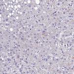 XKR7 Antibody in Immunohistochemistry (Paraffin) (IHC (P))
