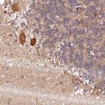 ARL11 Antibody in Immunohistochemistry (Paraffin) (IHC (P))