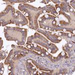 ARL11 Antibody in Immunohistochemistry (Paraffin) (IHC (P))