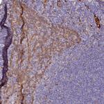 ARL11 Polyclonal Antibody