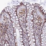 TGDS Antibody in Immunohistochemistry (IHC)