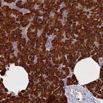 CCDC68 Antibody in Immunohistochemistry (Paraffin) (IHC (P))