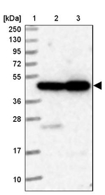 ELAC1 Antibody in Western Blot (WB)