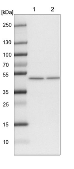 ELAC1 Antibody in Western Blot (WB)