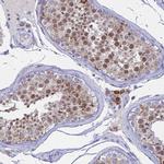 LOC81691 Antibody in Immunohistochemistry (IHC)