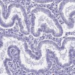LOC81691 Antibody in Immunohistochemistry (IHC)
