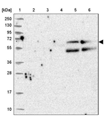 LOC81691 Antibody in Western Blot (WB)