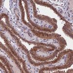 CCDC113 Antibody in Immunohistochemistry (IHC)
