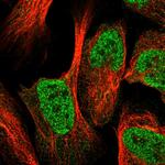 eIF6 Polyclonal Antibody