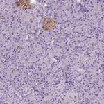 GNAO1 Antibody in Immunohistochemistry (IHC)