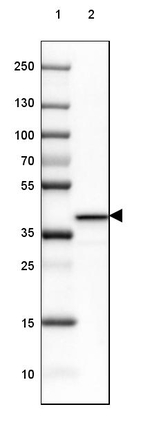 GNAO1 Antibody in Western Blot (WB)