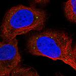 ANKRD2 Polyclonal Antibody