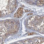 ARL11 Polyclonal Antibody