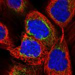 LRRC57 Polyclonal Antibody