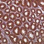 LRRC57 Antibody in Immunohistochemistry (Paraffin) (IHC (P))