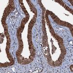 HDDC3 Antibody in Immunohistochemistry (Paraffin) (IHC (P))