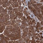 HDDC3 Antibody in Immunohistochemistry (Paraffin) (IHC (P))