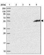 PGBD4 Antibody in Western Blot (WB)