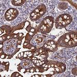 MYO5B Antibody in Immunohistochemistry (IHC)