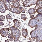 MYO5B Antibody in Immunohistochemistry (IHC)