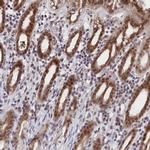 DNAJC17 Antibody in Immunohistochemistry (Paraffin) (IHC (P))